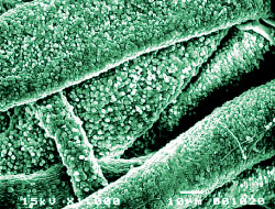 セルガイア繊維の電子顕微鏡写真